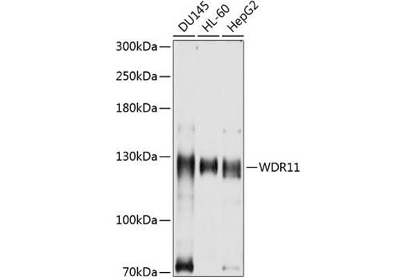 WDR11 Antikörper  (AA 975-1224)