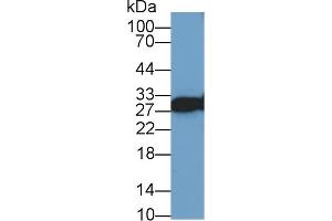Image no. 3 for anti-VAMP (Vesicle-Associated Membrane Protein)-Associated Protein A, 33kDa (VAPA) (AA 1-249) antibody (ABIN1078660)
