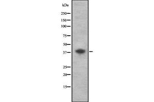 Image no. 1 for anti-CD72 Molecule (CD72) (Internal Region) antibody (ABIN6260647)