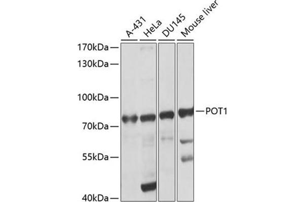 POT1 Antikörper  (AA 497-634)