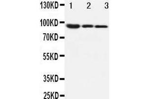 Image no. 4 for anti-Catenin (Cadherin-Associated Protein), beta 1, 88kDa (CTNNB1) (AA 764-781), (C-Term) antibody (ABIN3044344)