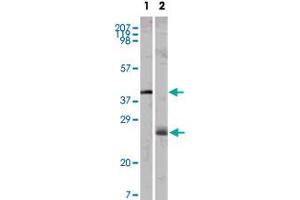 Image no. 1 for anti-Apolipoprotein M (APOM) antibody (ABIN5572769)