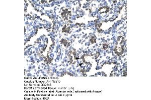 Image no. 2 for anti-FBJ Murine Osteosarcoma Viral Oncogene Homolog B (FOSB) (C-Term) antibody (ABIN2779692)