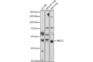 Western blot analysis of extracts of various cell lines, using RBCK1 antibody (ABIN7269848) at 1:1000 dilution.