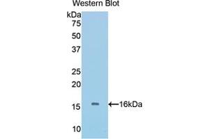 Image no. 3 for anti-Bone Morphogenetic Protein 5 (BMP5) (AA 201-314) antibody (ABIN1858159)