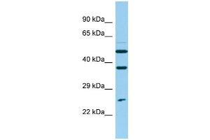 Image no. 1 for anti-Nudix (Nucleoside Diphosphate Linked Moiety X)-Type Motif 14 (NUDT14) (N-Term) antibody (ABIN2790829)