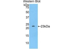Image no. 1 for anti-Sialic Acid Binding Ig-Like Lectin 12 (SIGLEC12) (AA 317-512) antibody (ABIN2911324)