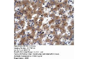 Image no. 2 for anti-Zinc Finger Protein 551 (ZNF551) (N-Term) antibody (ABIN2775059)