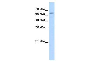 Image no. 2 for anti-Glucuronidase, beta (GUSB) (C-Term) antibody (ABIN205034)