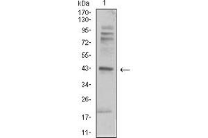 Image no. 5 for anti-Adrenergic, beta-2-, Receptor, Surface (ADRB2) (AA 302-413) antibody (ABIN5911929)