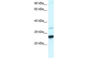 Image no. 1 for anti-Caudal Type Homeobox 1 (CDX1) (C-Term) antibody (ABIN927696)