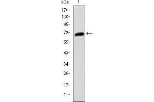 Image no. 3 for anti-Mast/stem Cell Growth Factor Receptor (KIT) antibody (ABIN969237)
