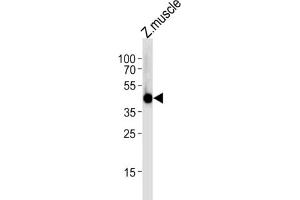 Image no. 1 for anti-Interferon Regulatory Factor 2 Binding Protein 2 (IRF2BP2) antibody (ABIN3004746)
