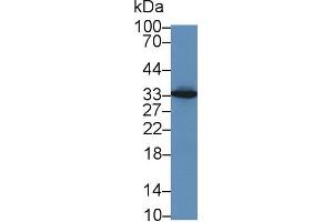 Image no. 2 for anti-HLA Class II DR alpha (HLA-DRA) (AA 28-232) antibody (ABIN1175589)