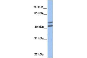 Image no. 1 for anti-Galactose-1-Phosphate Uridylyltransferase (GALT) (C-Term) antibody (ABIN631216)