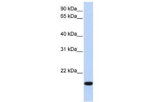 Image no. 1 for anti-Homeobox even-skipped homolog protein 2 (EVX2) (N-Term) antibody (ABIN929058)