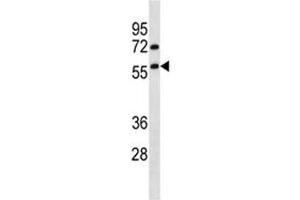 Image no. 2 for anti-Tripartite Motif Containing 13 (TRIM13) (AA 61-90) antibody (ABIN3029267)