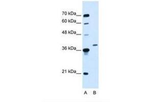 Image no. 1 for anti-Homeobox D11 (HOXD11) (AA 177-226) antibody (ABIN6737663)