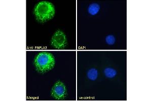 Image no. 5 for anti-Patatin-Like phospholipase Domain Containing 3 (PNPLA3) (Internal Region) antibody (ABIN361184)