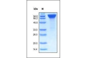 EGFR Protein (AA 25-645) (Fc Tag)
