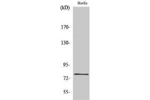 Image no. 1 for anti-SKI-Like Oncogene (SKIL) (C-Term) antibody (ABIN3187012)