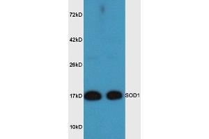 Mouse brain lysates probed with Rabbit Anti-SOD1 Polyclonal Antibody, Unconjugated  at 1:3000 for 90 min at 37˚C.