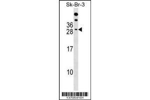 Image no. 1 for anti-RAP2B, Member of RAS Oncogene Family (RAP2B) (AA 102-129) antibody (ABIN1537716)