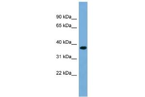 Image no. 1 for anti-Regulation of Nuclear Pre-mRNA Domain Containing 1B (RPRD1B) (Middle Region) antibody (ABIN2787267)