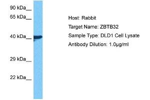 Image no. 2 for anti-Zinc Finger and BTB Domain Containing 32 (ZBTB32) (N-Term) antibody (ABIN2777470)