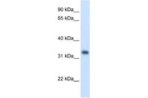 Image no. 1 for anti-3-Hydroxymethyl-3-Methylglutaryl-CoA Lyase (HMGCL) antibody (ABIN630162)