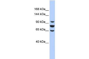 Image no. 1 for anti-Enhancer of Polycomb Homolog 1 (EPC1) (Middle Region) antibody (ABIN2777875)