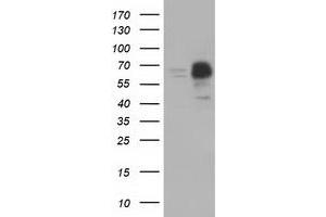 Image no. 1 for anti-Peroxisomal Biogenesis Factor 5 (PEX5) antibody (ABIN1500156)