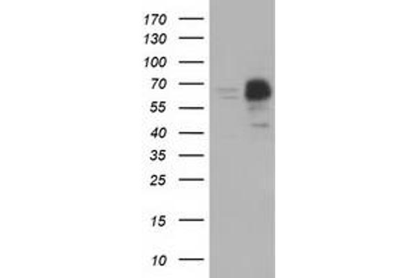 anti-Peroxisomal Biogenesis Factor 5 (PEX5) antibody