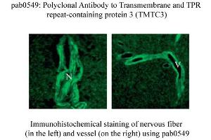 anti-Transmembrane and Tetratricopeptide Repeat Containing 3 (TMTC3) (C-Term) antibody
