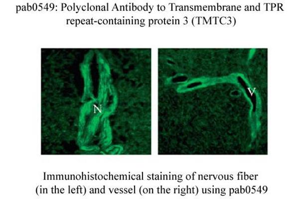 anti-Transmembrane and Tetratricopeptide Repeat Containing 3 (TMTC3) (C-Term) antibody