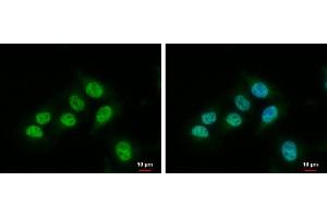 ICC/IF Image Heme Oxygenase 1 antibody detects Heme Oxygenase 1 protein at nucleus and cytoplasm by immunofluorescent analysis.