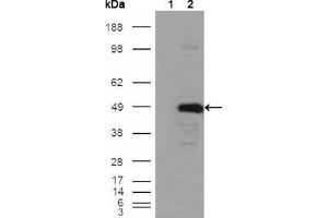 Image no. 2 for anti-Betaine--Homocysteine S-Methyltransferase (BHMT) antibody (ABIN968978)