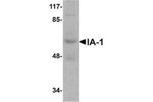 Image no. 1 for anti-Insulinoma-Associated 1 (INSM1) (N-Term) antibody (ABIN499952)