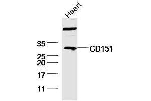 Image no. 4 for anti-CD151 (CD151) (AA 101-200) antibody (ABIN741525)