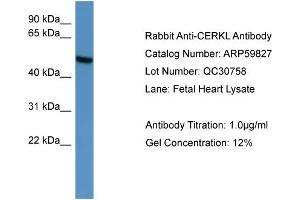 Image no. 2 for anti-Ceramide Kinase-Like (CERKL) (C-Term) antibody (ABIN2788232)