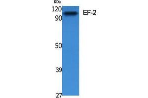 Image no. 2 for anti-Eukaryotic Translation Elongation Factor 2 (EEF2) (Ser311) antibody (ABIN3184410)