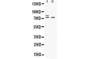 Image no. 1 for anti-Zinc Finger and BTB Domain Containing 16 (ZBTB16) (AA 1-165) antibody (ABIN4886774)