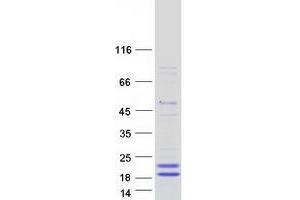 Image no. 1 for Phospholipase A2, Group X (PLA2G10) protein (Myc-DYKDDDDK Tag) (ABIN2729070)