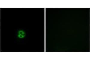 Image no. 1 for anti-Carbohydrate (N-Acetylglucosamine 6-O) Sulfotransferase 6 (CHST6) (AA 331-380) antibody (ABIN1534720)