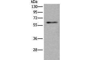 Western blot analysis of Mouse testis tissue lysate using SCP2 Polyclonal Antibody at dilution of 1:350