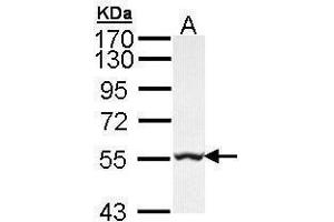 Image no. 2 for anti-Glycerate Kinase (GLYCTK) (Center) antibody (ABIN2855701)