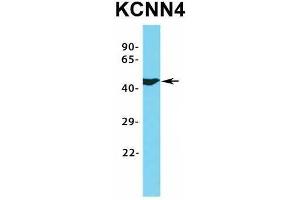 Image no. 5 for anti-Potassium Intermediate/small Conductance Calcium-Activated Channel, Subfamily N, Member 4 (KCNN4) (C-Term) antibody (ABIN2776147)