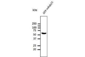 Image no. 2 for anti-RAB25, Member RAS Oncogene Family (RAB25) (C-Term) antibody (ABIN1440003)
