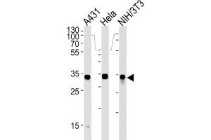 Image no. 3 for anti-Malate Dehydrogenase 2, NAD (Mitochondrial) (MDH2) antibody (ABIN3001706)