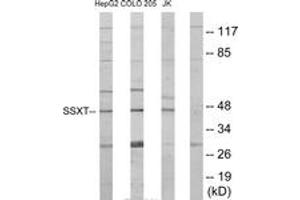 Image no. 1 for anti-Synovial Sarcoma Translocation, Chromosome 18 (SS18) (AA 1-50) antibody (ABIN1533910)